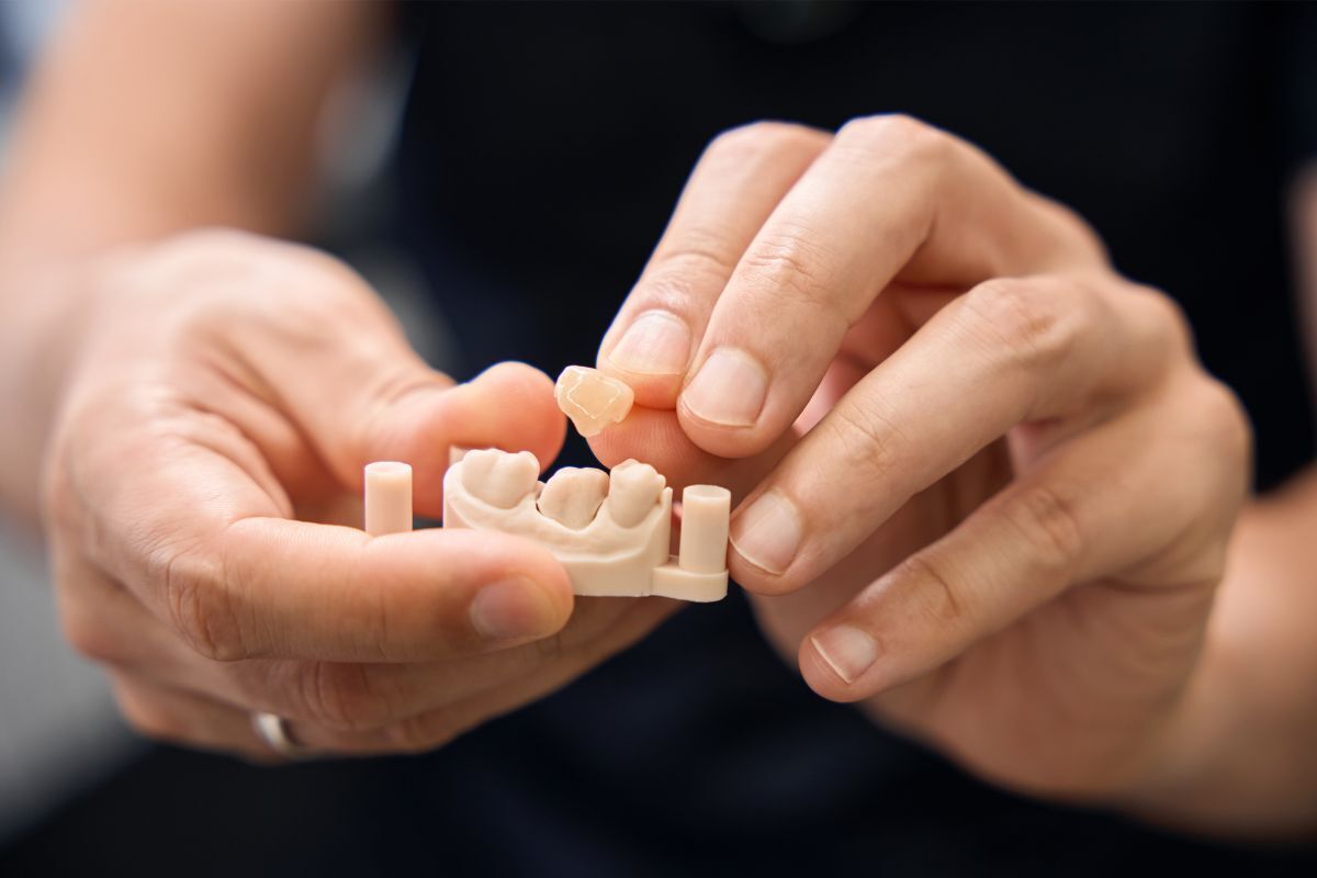 Crown vs Filling: Which Does Your Tooth Need?