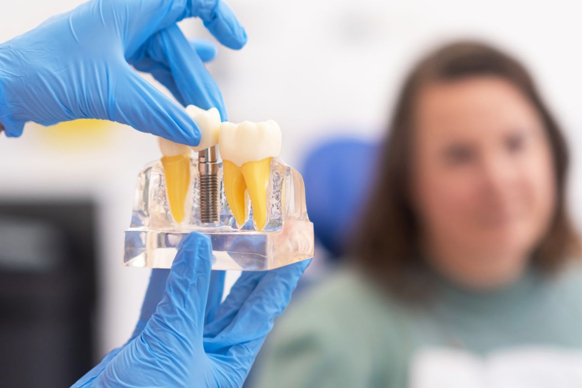 best tooth replacement options